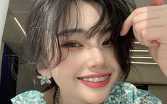 Niềng răng sai cách: Gây lệch mặt, sưng hàm, đau khớp