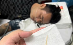 Xử lý thành công ca: Gắp dị vật tăm tre xuyên thủng dạ dày bằng nội soi cấp cứu