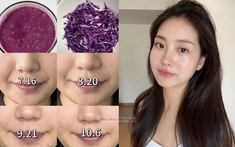 "Thần dược" lich truc tiep bong da ngoai hang anh trắng da, giảm rụng tóc giá rẻ bèo được phụ nữ Trung Quốc yêu thích