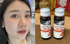 Tôi đã 39 tuổi nhưng da vẫn săn chắc nhờ 7 năm uống collagen