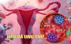 Bạn biết gì về HPV - Tác nhân tăng nguy cơ ung thư cổ tử cung?