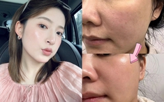 5 lọ serum tăng cường collagen rất cần cho phụ nữ ngoài 30 tuổi