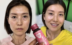 Chụp ảnh mặt mộc hàng ngày trong 1 tháng uống collagen, có điểm này trên mặt thay đổi mà tôi thấy rõ