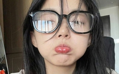 Đi khám tiền mổ cận mà nhận thấy 4 tín hiệu này, nhanh chóng “quay xe” còn kịp!