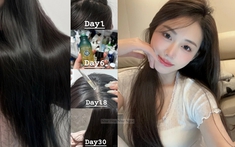 5 lọ serum "chân ái" cho hội rụng tóc, ngoài hiệu quả chống rụng thì còn giúp tóc bóng mướt từ chân