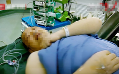 Mắc bệnh tim sau 1 năm chạy bộ mỗi sáng, nguyên nhân gây bất ngờ