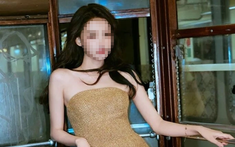 “Mặt sưng phù, phải truyền dịch suốt 2 ngày” vì nhuộm tóc, một nữ diễn viên nổi tiếng thú nhận