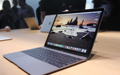 Nên mua MacBook hay laptop Windows? So sánh chi tiết để chọn đúng