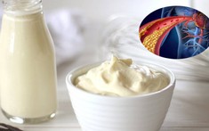 Loại thực phẩm giới trẻ đặc biệt yêu thích nhưng cẩn trọng kẻo gây rối loạn mỡ máu