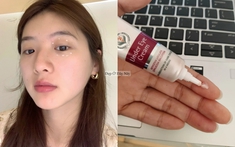 5 kem mắt bình dân giúp "là phẳng" nếp nhăn và mờ thâm thấy rõ