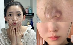 Không cần ra spa, có 5 cách làm sạch sâu lỗ chân lông tại nhà để da láng mịn từ bên trong