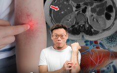 Phó Giám đốc Bệnh viện Thái Lan cảnh báo 4 dấu hiệu trên da là "lời kêu cứu" của gan, nhiều người bỏ qua rồi hối hận không kịp