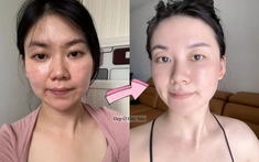 Không cần mỹ phẩm đắt tiền, đây là cách cô nàng ngoài 30 tuổi giữ da trẻ lâu