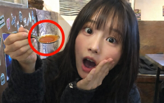 Ngày càng nhiều người còn trẻ đã "vật vã" vì bệnh thận, bác sĩ nói thẳng: 5 thói quen này "phá thận" nhanh hơn nhịn tiểu