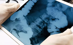 Cả bệnh viện hoảng loạn, sơ tán ngay lập tức vì điều này ở chàng trai 24 tuổi