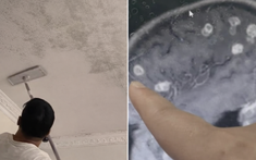 Bé gái 6 tuổi bị "đục" 20 lỗ ở não, suýt thành người thực vật: 5 góc khuất chứa đầy “chất độc vô hình” phải cẩn trọng khi dọn dẹp nhà đón Tết