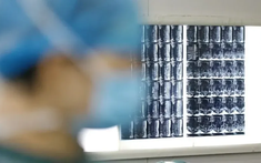 5 loại viêm tưởng nhẹ  thực chất là “chuông báo ung thư”: càng dập sớm, rủi ro càng thấp