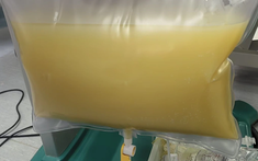 Nam sinh năm nhất "máu trắng như sữa", mỡ máu cao gấp 47 lần bình thường vì thói quen ăn uống nhiều người mắc