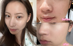 Tái sinh làn da trong giấc ngủ với 5 lọ serum đêm giá bình dân ai dùng cũng khen