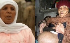 Người phụ nữ mang thai suốt 46 năm mà không hề hay biết cho đến khi 75 tuổi