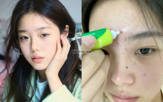 5 lọ kem chấm mụn "made in Vietnam" vừa xẹp mụn nhanh vừa ngừa thâm rất ổn