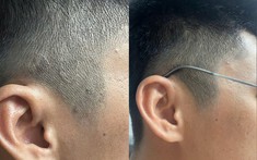 Xu hướng chăm sóc da đầu mới: Không chỉ sạch gàu mà còn phải “sạch bền vững”