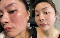 Tôi từng “ném tiền qua cửa sổ” vì mê spa, cho đến khi nhận ra: Chỉ cần 3 phút đắp lotion mỗi ngày, da cũng có thể đẹp lên