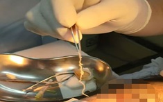 "Sốc nặng" với chàng trai 24 tuổi nhưng 13 năm bị sinh vật sống "gặm nhấm" não, gây tàn tật: Gắp ra ngoài còn ngoe nguẩy