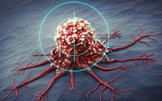 Một năm trước khi ung thư phát triển, cơ thể sẽ phát ra 5 dấu hiệu cảnh báo, nhưng 90% người lại bỏ qua