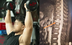 Người đàn ông 34 tuổi xương giòn như bà cụ 60 tuổi vì ngày nào cũng uống 3 cốc loại nước nhiều người không thể sống thiếu