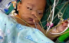 Kỳ lạ em bé 5 tháng tuổi nôn mửa và chán ăn nhưng không khóc tiếng nào, bác sĩ phát hiện sự thật đáng sợ phía sau