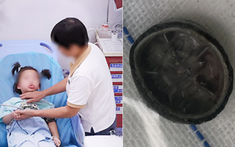 Bé gái 6 tuổi chảy máu vùng kín suốt 4 năm, đi khám mới phát hiện thứ “không ai ngờ” bên trong
