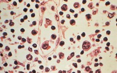 Virus Hanta: Xác nhận 6 ca nhiễm, nguy cơ lây lan toàn cầu ở mức thấp