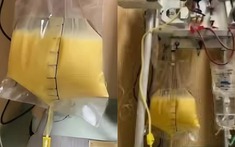 Người phụ nữ ra "máu trắng như sữa", bác sĩ lên tiếng cảnh báo