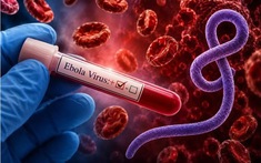 Sát thủ vô hình Ebola: Nhận diện đúng để không hoảng loạn