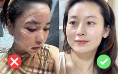 Mua serum làm trắng theo review: Nghe có vẻ đúng, nhưng dễ sai!