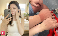 Bôi kem chống nắng kiểu này, da không chỉ sạm đen mà còn lão hóa nhanh