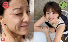 6 thói quen tai hại khiến nếp nhăn vùng mắt ngày càng hằn sâu, đẩy nhanh lão hóa