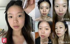 Review 1 tháng dùng serum vitamin C: Làn da có thêm "điểm cộng" nhưng cũng cần lưu ý