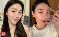 Thử thách không rửa mặt trong 10 ngày, cô nàng nhận kết quả "không như mơ"
