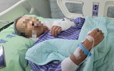 Người đàn ông 53 tuổi mắc cùng lúc 5 loại ung thư vì 2 thú vui của nhiều người Việt
