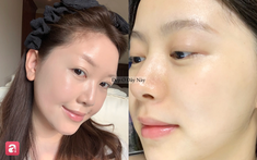 5 lọ serum "retinol kiểu mới" giúp da căng bóng, hỗ trợ tăng sinh collagen mà không lo bong tróc