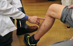 Các bác sĩ nói thẳng: Bắp chân là "đèn báo" đột quỵ, thấy 5 thứ phải đến bệnh viện ngay!