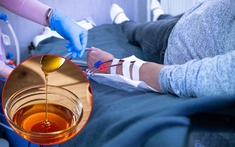 Uống 2 lít nước mật ong mỗi ngày để dưỡng thận, người đàn ông càng suy thận nặng, phải lọc máu nhân tạo