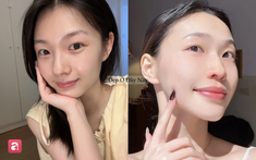 6 lọ serum retinol được đánh giá cao nhất