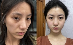 5 thói quen khiến collagen "rút cạn" mỗi ngày nhanh hơn bạn tưởng