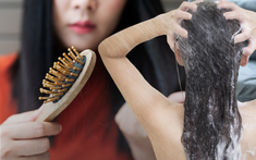 Gội đầu kiểu này cực hại da đầu lại dễ gây hói: Đáng tiếc nhiều người Việt vẫn mắc, thay đổi ngay hôm nay để cứu lấy mái tóc