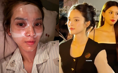 Bà chủ resort miền Tây từng khiến Tiểu Vy "out nét" khi đứng cạnh nay gặp kiếp nạn nhan sắc