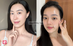Tuổi 35+ nên đầu tư 5 lọ serum làm sáng da này để những đốm nám không có cơ hội đậm lên