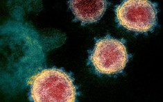 Vì sao truy tìm nguồn gốc virus SARS-CoV-2 giống như “mò kim đáy bể“?